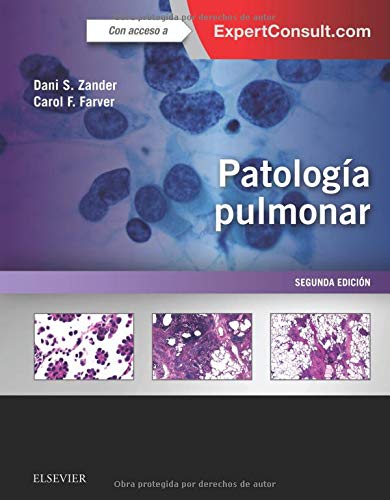 Livro Patologia Pulmonar de Juan Antonio García González (Espanhol) Elsevier España, S.L.U. - Livros - patologia pulmonar, 36 capítulos, diagnóstico, radiográficas