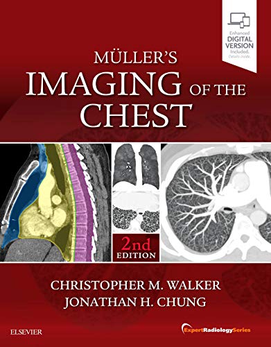 Livro Müller'S Imaging Of The Chest de John M. Müller (Inglês) Collectif - Livros - imagem, torax, medicina